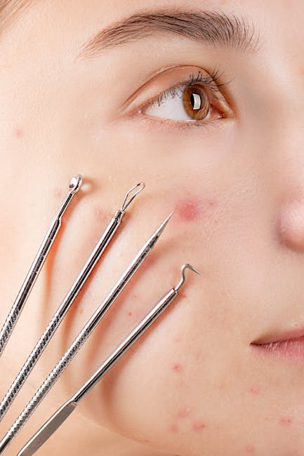 Close-up image of a young person's face with clear skin and light complexion, focusing on the cheek and eye area. Several stainless steel cosmetic extraction tools with different shapes and sizes are positioned carefully against the skin, indicating a skincare or minor facial treatment process. The background is neutral and softly blurred, emphasizing the area of skin and tools. This image visually represents facial skin care procedures or treatments, which can be associated with personal grooming, health, and beauty routines, relevant in contexts of well-being and skincare, indirectly supporting content related to home and personal space management. The lighting is bright and natural, highlighting the textures of the skin and the metallic sheen of the tools.